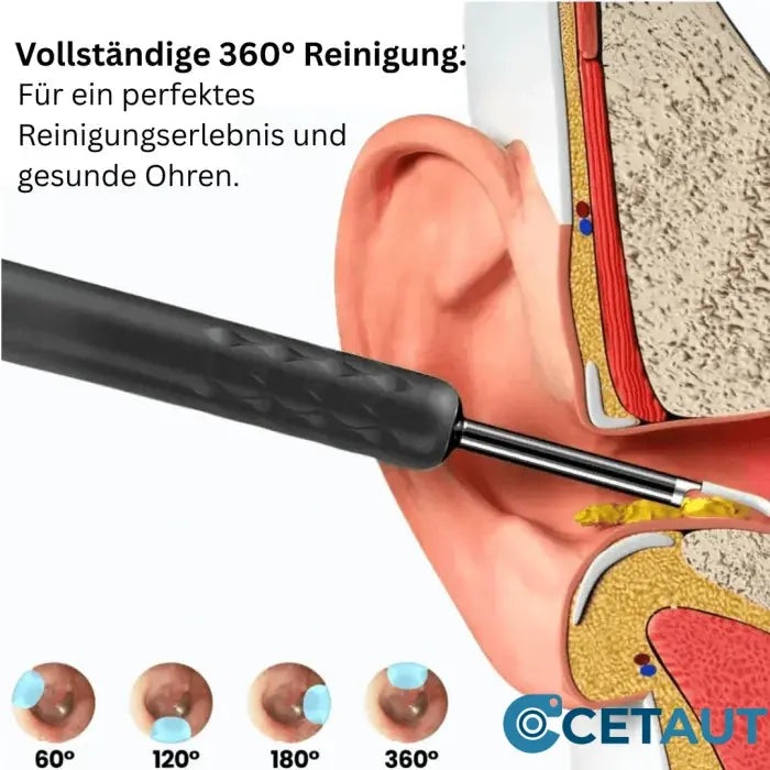 LUNAVA™ Pro Ohrenschmalz-Entfernungsgerät mit HD-Kamera cetaut