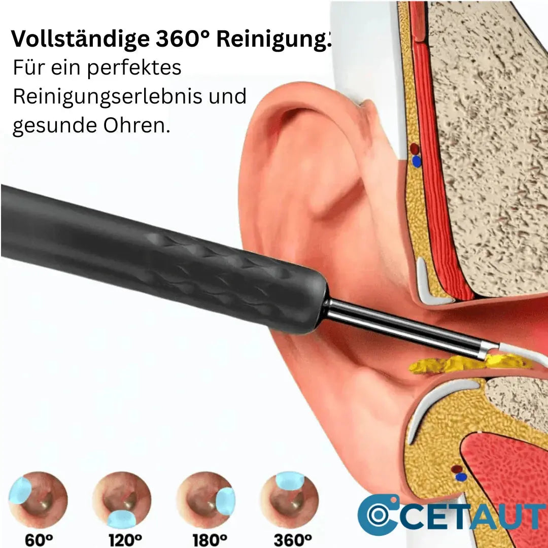 🔍Smartes Ohr-Reinigungstool – Sauber. Sicher. Sichtbar cetaut
