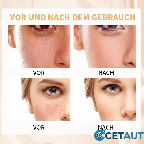 🎁Letzter Tag - Kaufe 2 und erhalte 1 gratis🎉Farbwechselnde Foundation für reife Haut cetaut
