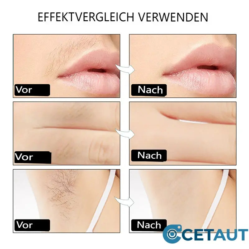 👉Glatt wie Seide, stark wie Wachs – 28 Tage ohne🔥  Rasieren50% RABATT🔥  auf 90er Pack Wachsstreifen zur Haarentfernung – Jetzt glatte Haut genießen! cetaut