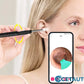 LUNAVA™ Pro Ohrenschmalz-Entfernungsgerät mit HD-Kamera cetaut