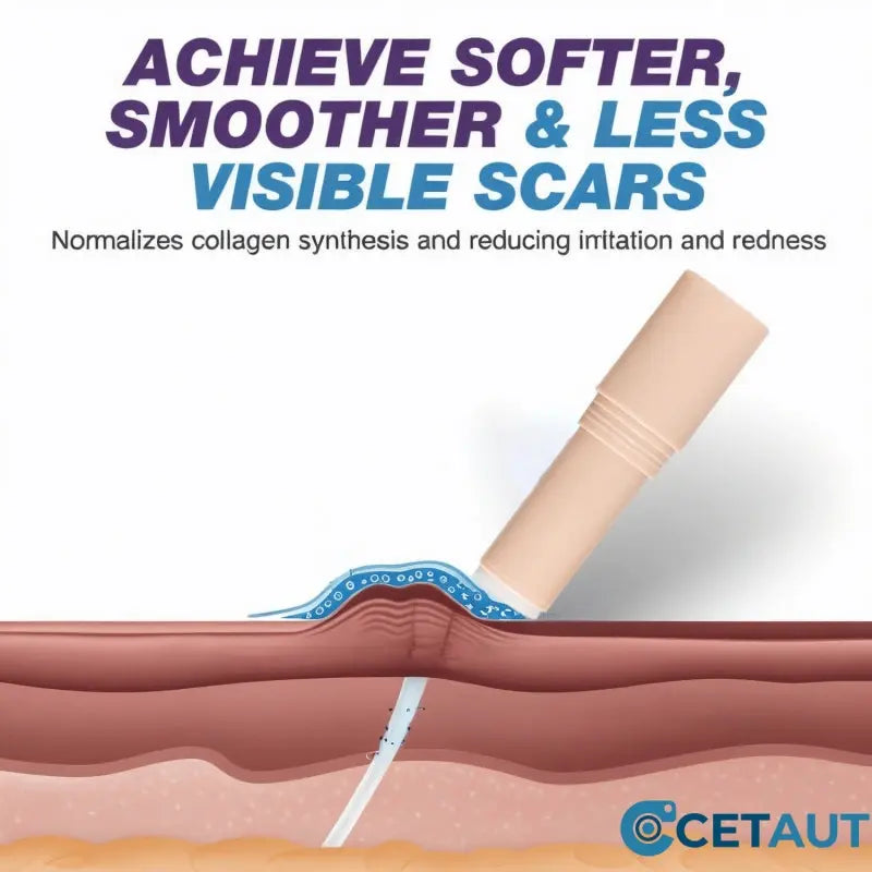 Silicone Scar Healing Stick cetaut