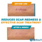 Silicone Scar Healing Stick cetaut
