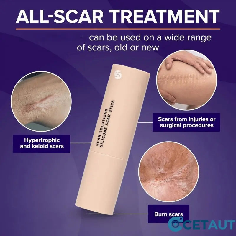Silicone Scar Healing Stick cetaut