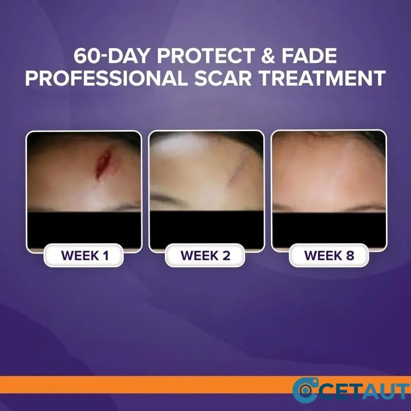 Silicone Scar Healing Stick cetaut